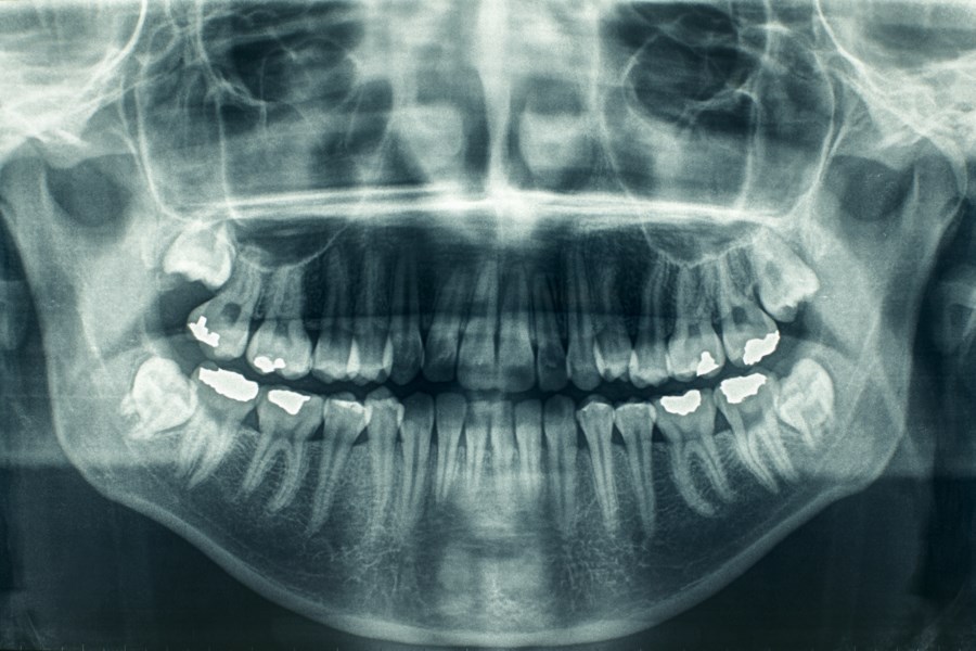 oral diagnoz